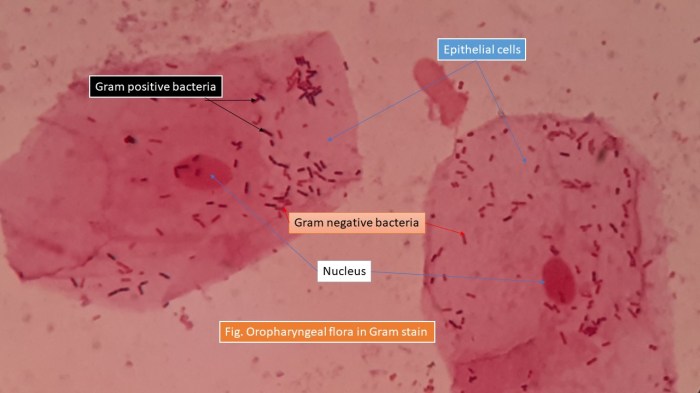 Normal flora skin bacteria ppt examples where opportunistic significant powerpoint presentation